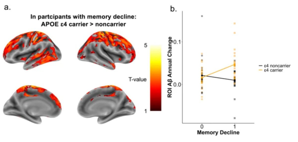 GeroScienceAGE's tweet photo. 📢New open🔓 access article found that #APOEɛ4 carriers with #memorydecline show accelerated #amyloidbeta accumulation and #graymatteratrophy at #predementia stages, highlighting the importance of early monitoring and repeated #cognitiveassessments over baseline diagnosis in predicting #alzheimersdisease progression. (Maha Wybitul & Valerie Treyer- @tcshell2 et al. for the Alzheimer’s Disease Neuroimaging Initiative.)

https://t.co/msxCn8fMuA

#aging #Biomarkers #neuroimaging #atrophy