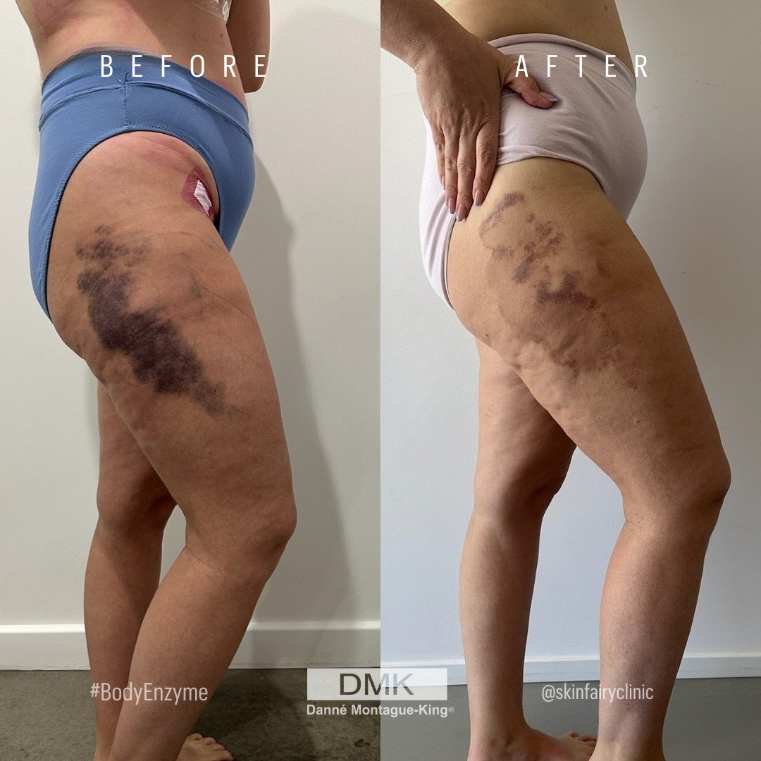 💚 DMK International | Professional Skincare 💚 tweet media