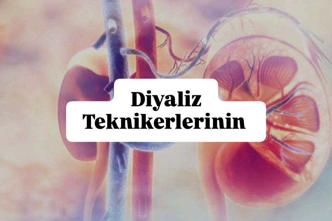 sterildiyalizor's tweet photo. @ahmetesmer2121 @drmemisoglu Aylardır 80+ puanlarla atama bekliyoruz. Diyaliz teknikerleri olarak yıllardır uygulanmayan yönetmeliğin takipçisiyiz. Mağduriyetimizi güçlü bir atama ile telafi etmenizi umut ediyoruz.
@drmemisoglu 
@memetsimsek @saglikbakanligi @sbkhgm https://t.co/bkGa10VLOQ