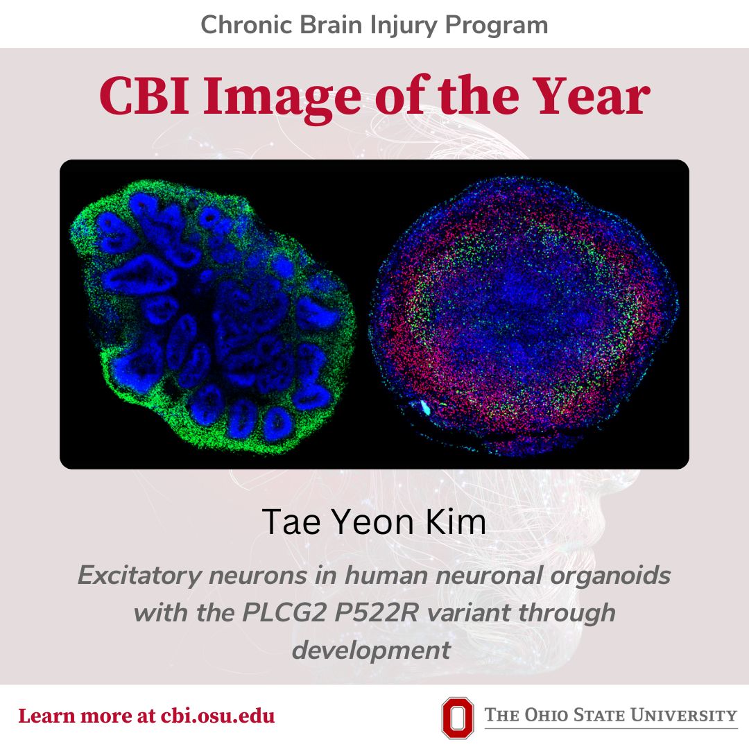 Congrats to CBI #Image of the Year winner Tae Yon Kim and mentor <a href="/HarryFu80763542/">Harry Fu</a>! The image visualizes excitatory neurons in a novel neural organoid model. A great blend of #science and #art ! #OhioStateCBI #cbird25