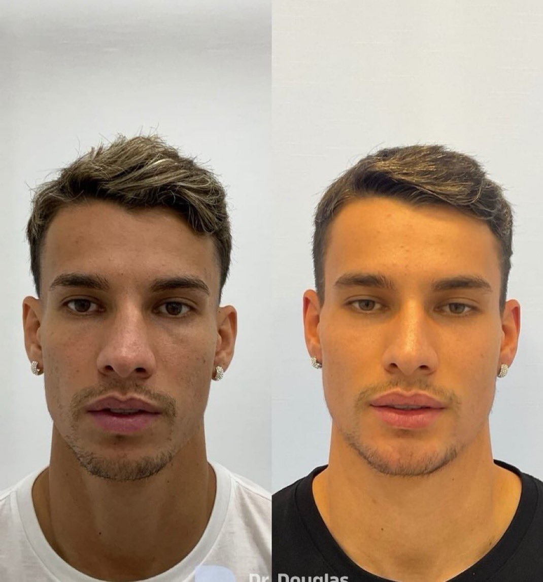 jprsgarbi's tweet photo. @SaoPauloFC bora bancar harmonização facial em todos os atletas, é a solução 🙌🏼🙌🏼🙌🏼 https://t.co/YjZ2V3URLT