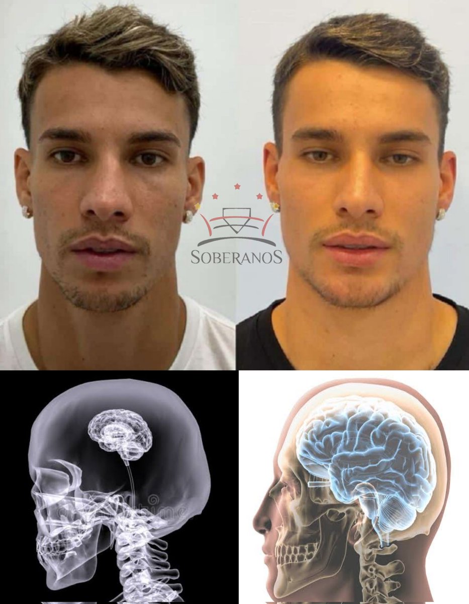 OdinSPFC's tweet photo. OBRIGADO DOUTOR QUE INVENTOU A HARMONIZAÇÃO CEREBRAL 🙏🏻 https://t.co/PGtysJcv8X