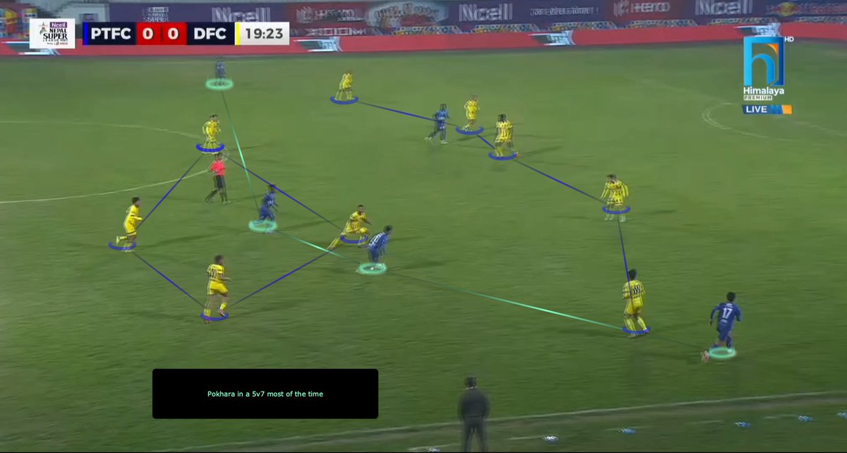npkorneev's tweet photo. Pokhara Thunders stuck to the same approach they’ve employed throughout the tournament, deploying a 4-1-4-1 system. However, they struggled to generate scoring opportunities due to limited movement in the attacking third and a significant numerical disadvantage against Dhangadhi’s 5-1-2-1-1 defensive setup. Despite a strong showing from their pivot, Suraj Thakuri (#23), Pokhara found it challenging to advance the ball to their 8s (#10 and #13), who were frequently outnumbered in 3v2 situations, with Dhangadhi’s #39 closely marking Thakuri. As a result, Pokhara Thunders faced considerable difficulty creating chances, managing only a handful of shots throughout the match.