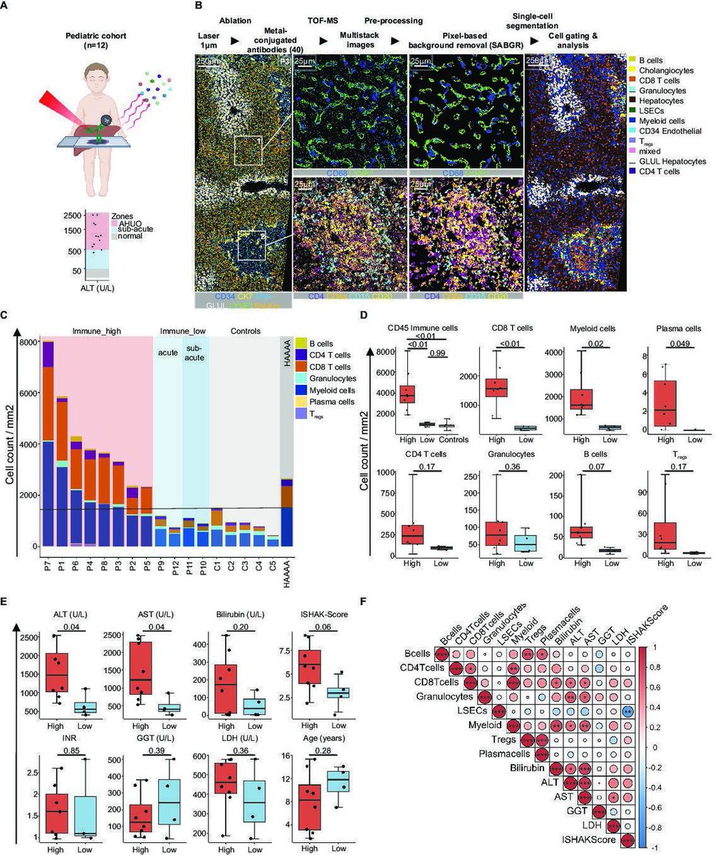Gut_BMJ's tweet photo. #GUTOnline paper by Röttele et al on 

"Characteristic immune cell interactions in livers of children with acute hepatitis revealed by spatial single-cell analysis identify a possible postacute sequel of COVID-19" via

https://t.co/qLbR1Hik6X

@teximmed2 @therealbbengsch #COVID19 #Hepatitis