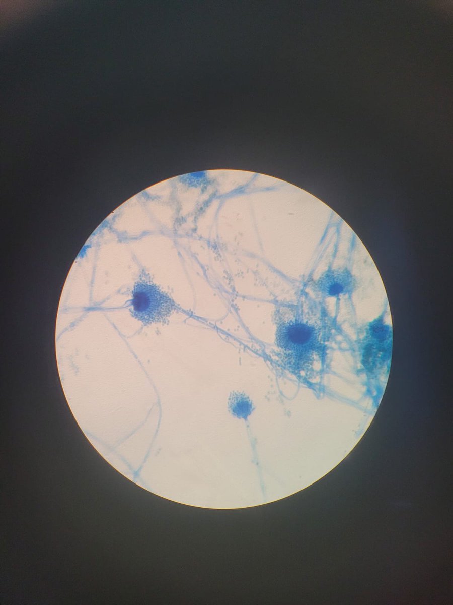 Smoking_2021's tweet photo. @Nickq_OFC Ela se tornará uma Aspergillus! https://t.co/u0bJpQbGw5