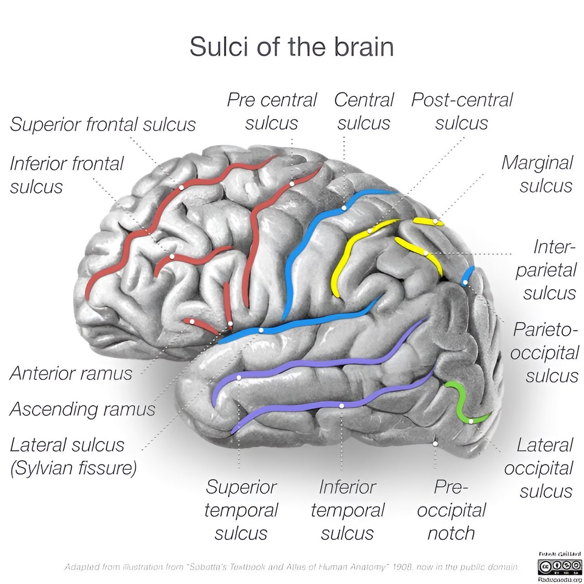 seraj25's tweet photo. From Radiopaedia https://t.co/v73RTrAoTr