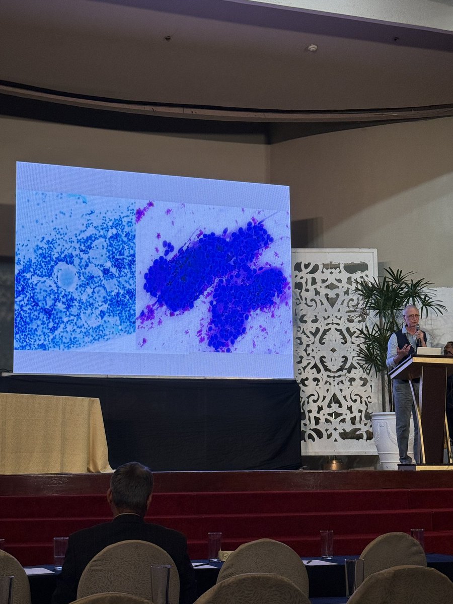 Slide sesh at #PSPAC2025 — breast, lung, liver on deck! Learned a lot and leveled up again. Big thanks to the brilliant speakers, Dr. Tse and Dr. Aydin! #Cytopathology #1Purpose1StrongPathTo75