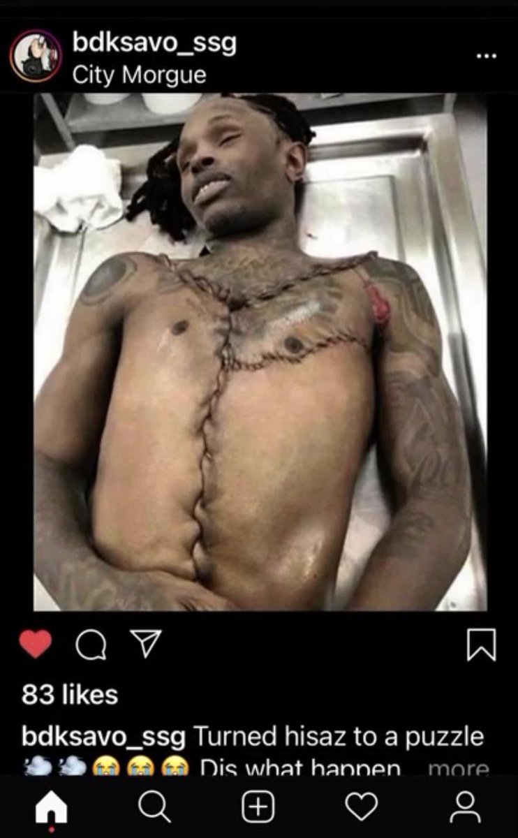KingAllYear's tweet photo. @yufeardrill @pluggjoe Idc for pab lol , I look at this autopsy and laugh my ass off at u niggas 🤣 don’t baby got a rico coming ?? Haha yb out about to tour and von a puzzle, durk fighting for his life and baby scared like a lil hoe rn😂😂😂 https://t.co/3LTJ64TsbM