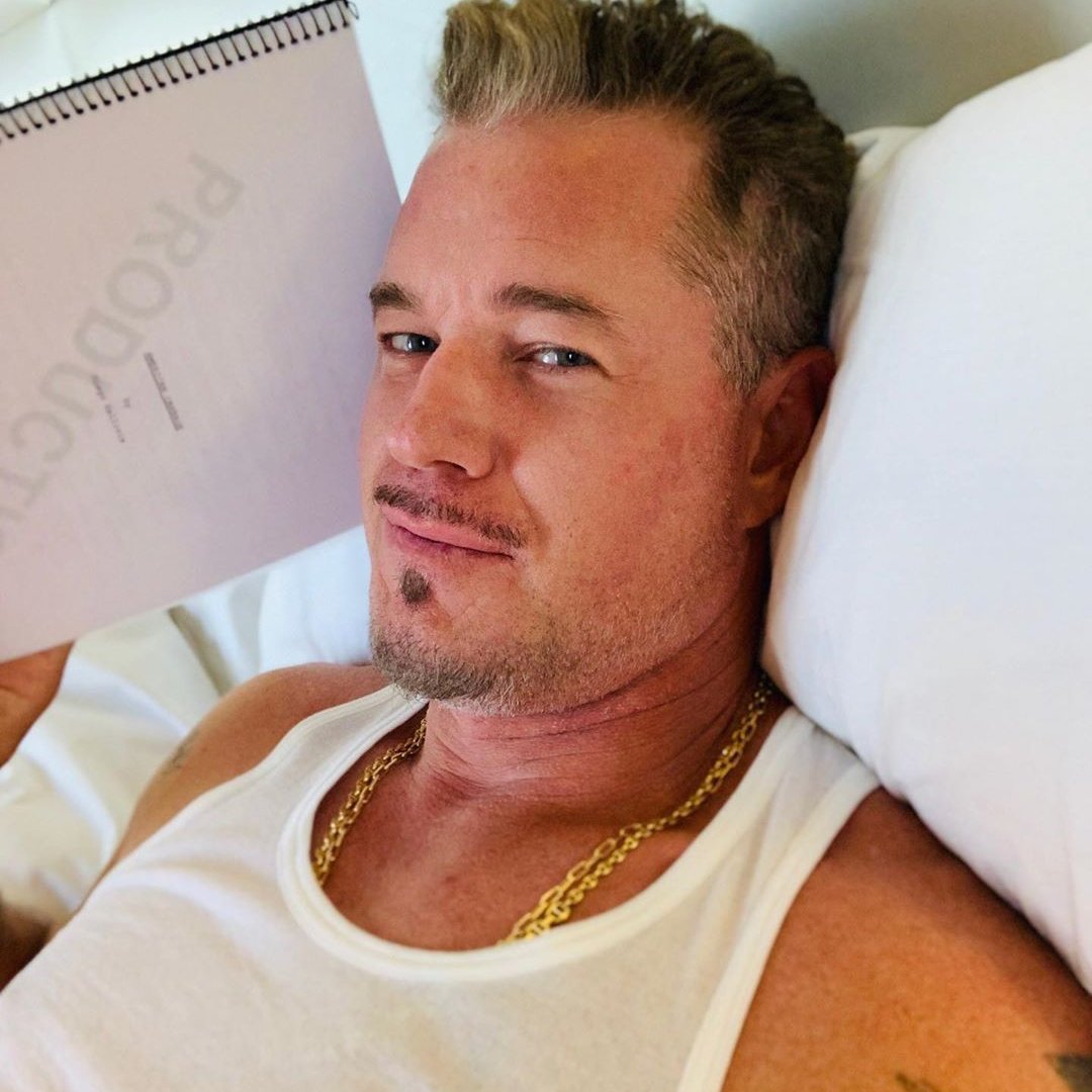 sboficial's tweet photo. 🚨 Eric Dane é diagnosticado com a doença de ELA.

Também conhecida como doença de Lou Gehrig, é uma doença degenerativa rara que causa paralisia progressiva dos músculos, onde os pacientes perdem lentamente a capacidade de falar, comer, andar e respirar de forma independente. https://t.co/OgNSJ9eAZc