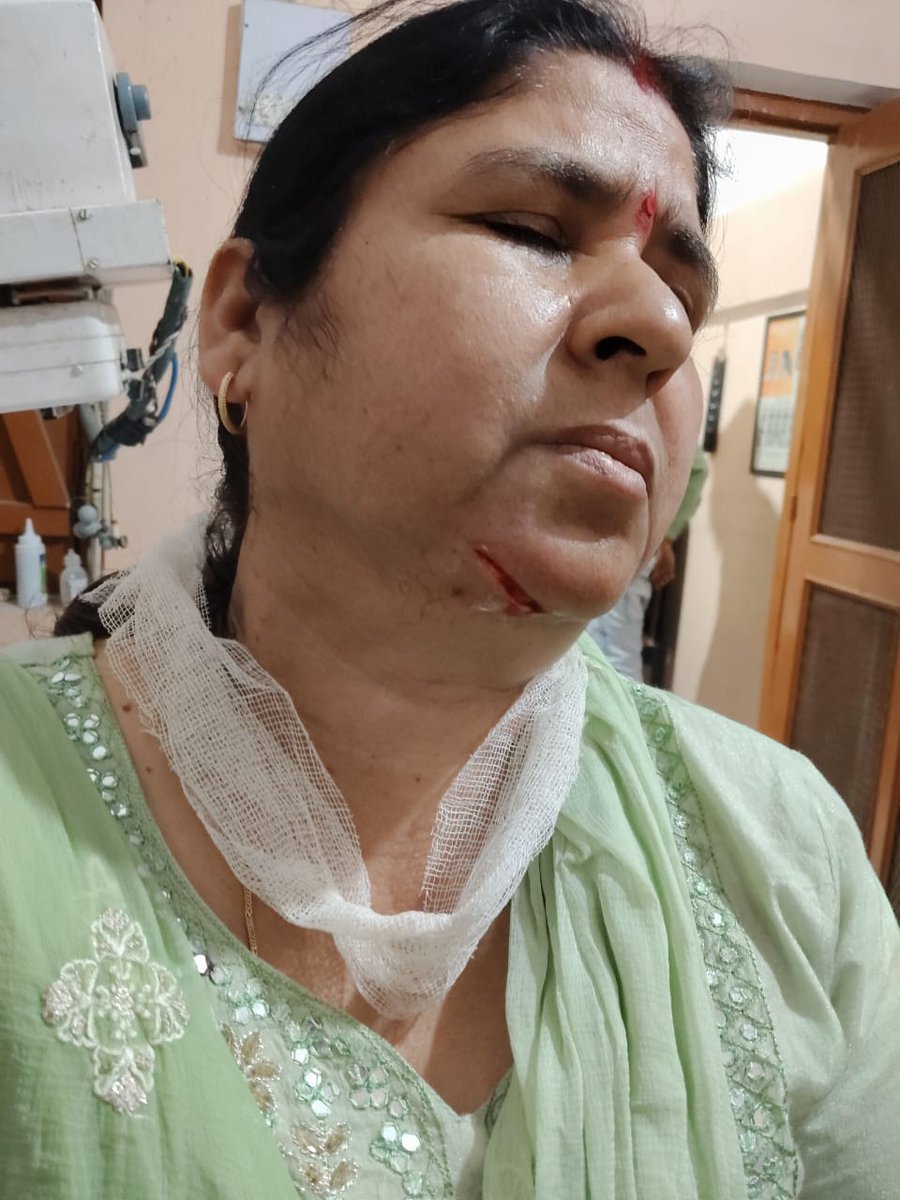 साथियों,
आप सबको अवगत कराना है कि आज यूपीएस गुलरिया,महोली मे आईसीटी लैब स्थापति करने आए लोगों ने विवाद करते हुए शिक्षिका श्रीमती शाकाम्बरी मिश्र पर जानलेवा हमला कर घायल कर दिया। 
<a href="/BsaSitapur/">अखिलेश प्रताप सिंह BSA Sitapur</a>

🙏🙏🙏