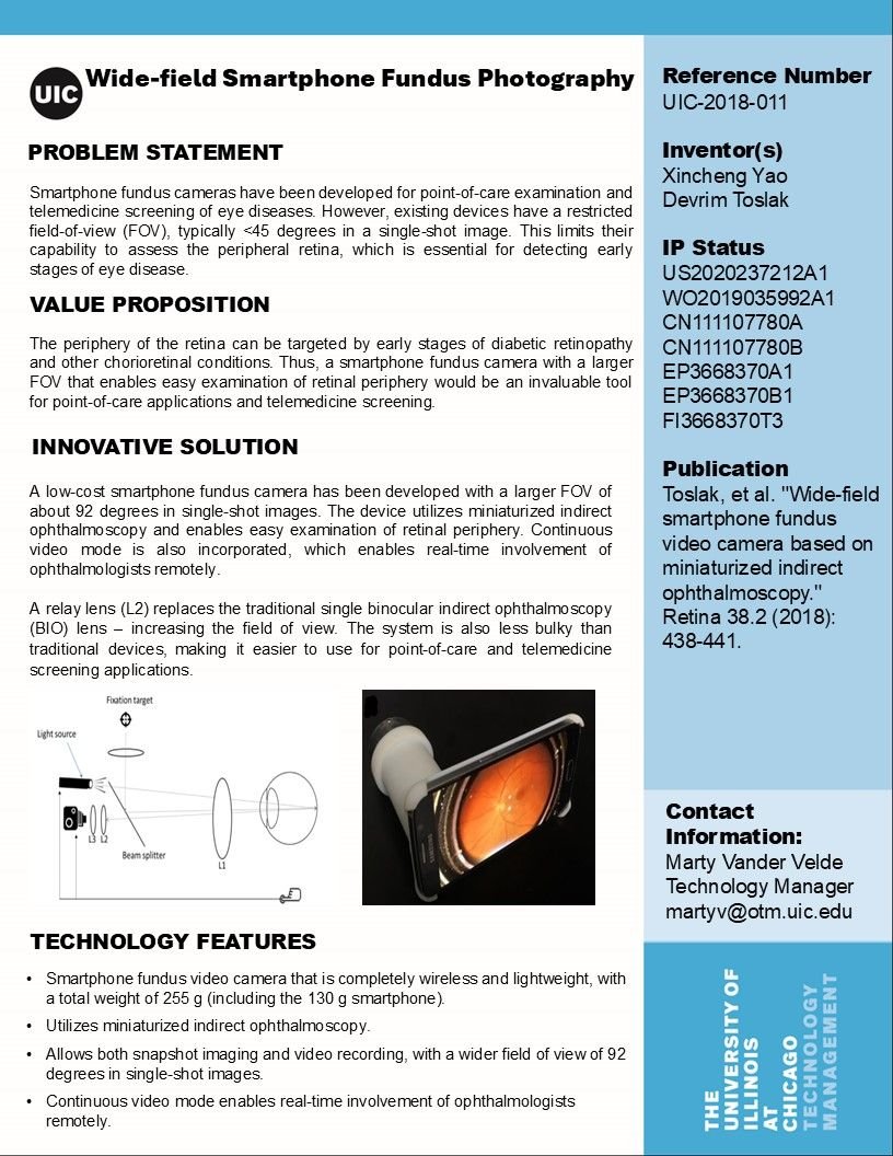 Revolutionary solution from UIC inventors now available for licensing!
UIC researchers have developed a low-cost smartphone fundus camera with an impressive 92° field of view in a single shot! This breakthrough device uses miniaturized indirect ophthalmoscopy for easy retinal