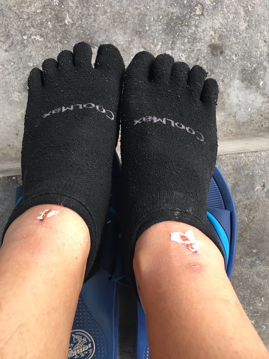 20250411
也不知道干了什么
昨天全身酸痛
特别是两条腿子
另外有磨到图片位置的吗？
我也是第一次遇到
礼拜二跑完就这样了
哭死