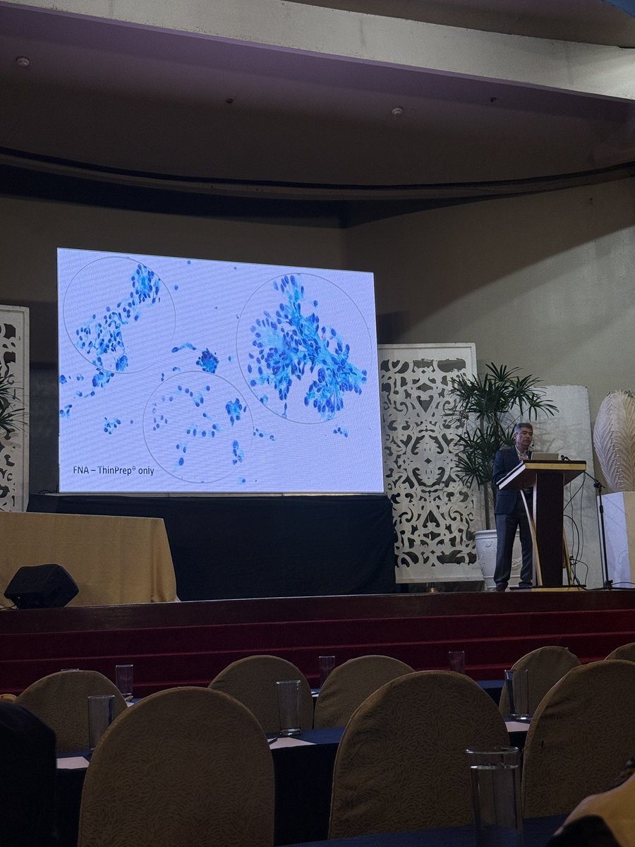 Smeared, stained, and stunned — the #PSPAC2025 Cytology Slide Session had us all swiping through Serous, Urine, Thyroid, and Salivary gland cases! Challenging yet rewarding. Hats off to the speakers (Dr. Chandra and Dr. Baloch) for keeping us learning and entertained!
