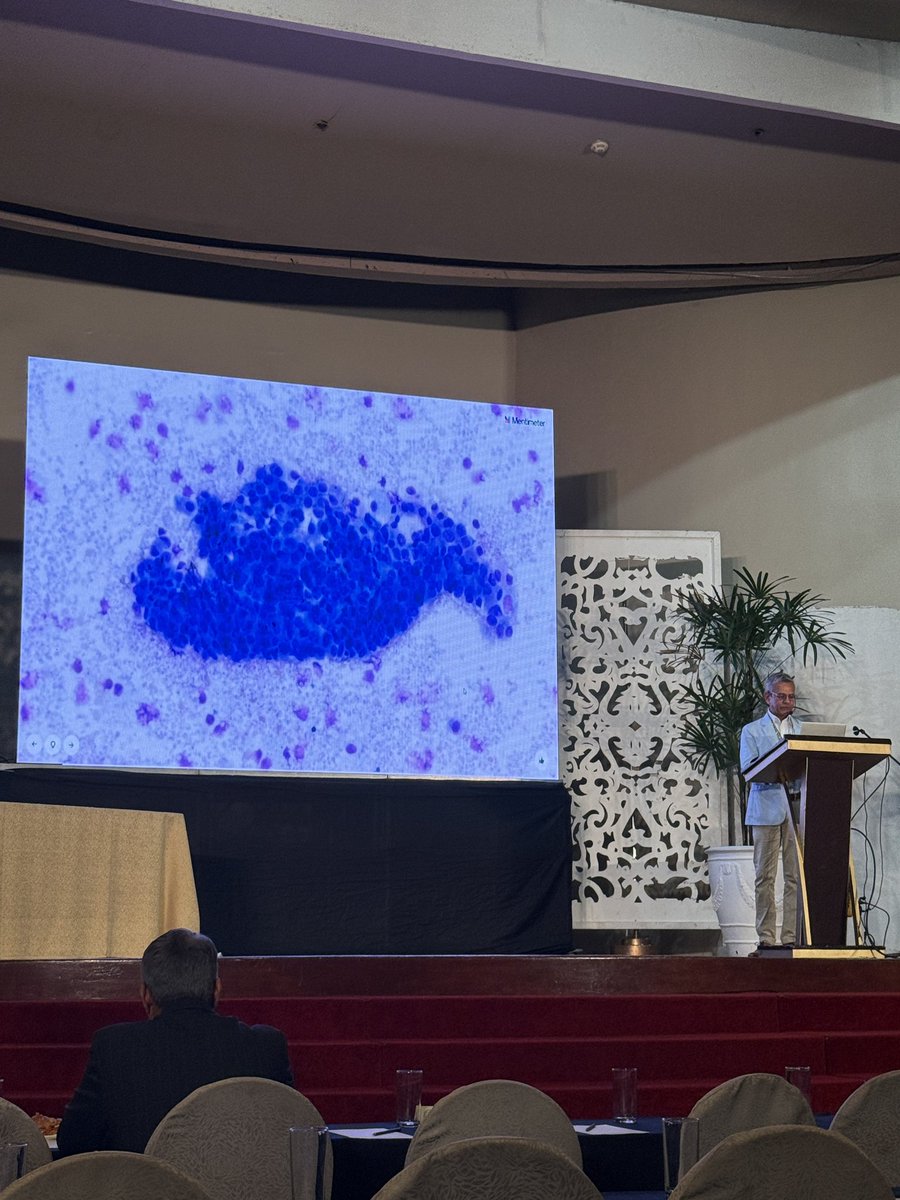 letsgoPatho's tweet photo. Smeared, stained, and stunned — the #PSPAC2025 Cytology Slide Session had us all swiping through Serous, Urine, Thyroid, and Salivary gland cases! Challenging yet rewarding. Hats off to the speakers (Dr. Chandra and Dr. Baloch) for keeping us learning and entertained! https://t.co/c8Ay1kK6NF