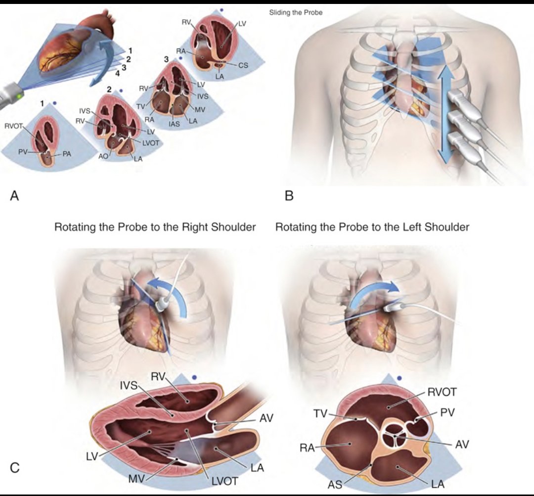 CardiovascularCorner tweet media