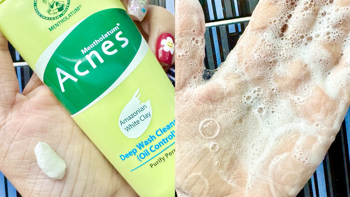 โฟมลดสิวเวชสำอางที่ใช้มาตลอด Mentholatum Acnes Deep Wash Cleanser เมื่อก่อนเคยสิวเยอะกว่านี้มากกกก เดี๋ยวนี้จะขึ้นนิดๆหน่อยๆช่วงเมนส์มา เค้ามีสารสกัดที่ช่วยลดสิวอุดตันและสิวอักเสบ แถมยังมี Whiteclay ช่วยคุมมัน ดูดซับความมันได้ดีด้วย  ใช้แล้วรู้สึกว่าหน้าสะอาด ไม่มันไม่แห้งตึง ฟองโฟมนุ่ม ไม่บาดผิว หาซื้อได้ง่ายๆที่ 7-11 น้าาา 😻 #โฟมลดสิวผิวมัน #เมนโทลาทั่มแอคเน่ส์ #โฟมลดสิวเซเว่น