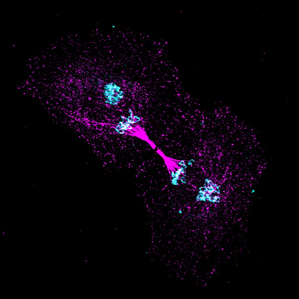 "The Last Kiss"

These are T24 bladder cancer cells captured in the final moments of division. The Golgi, shown in turquoise, is split into two pools per cell, while acetylated tubulin, shown in magenta, is concentrated in the midbody. #FluorescenceFriday