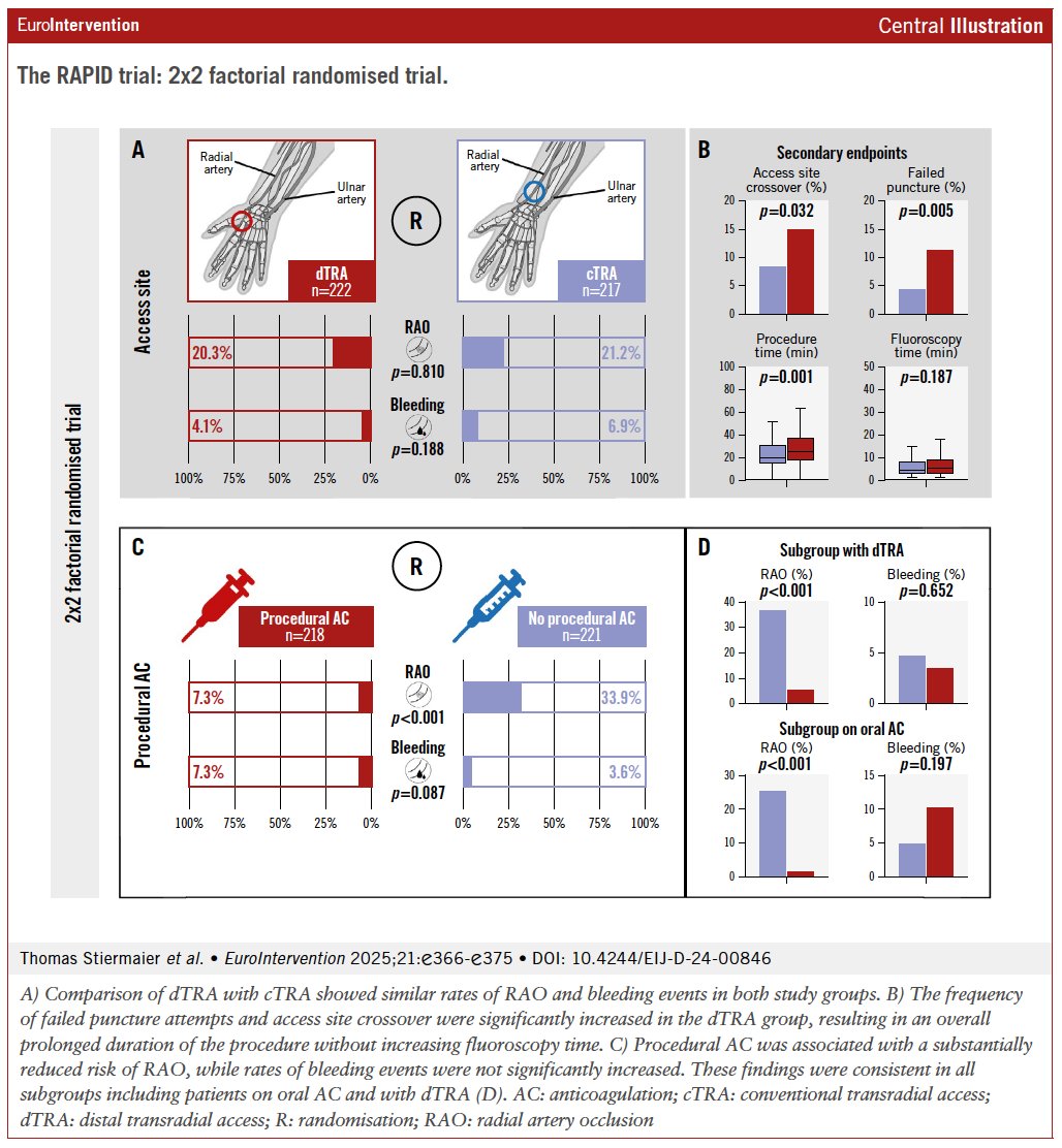 EuroIntervention (@eurointerventio) on Twitter photo The randomized RAPID trial showed procedural anticoagulation significantly reduces radial artery occlusion (RAO) after diagnostic coronary angiography — including in patients with distal radial access and those on oral anticoagulants. <a href="/t_stiermaier/">Thomas Stiermaier</a> <a href="/IngoEitel/">Ingo Eitel</a>
No RAO benefit seen The randomized RAPID trial showed procedural anticoagulation significantly reduces radial artery occlusion (RAO) after diagnostic coronary angiography — including in patients with distal radial access and those on oral anticoagulants. <a href="/t_stiermaier/">Thomas Stiermaier</a> <a href="/IngoEitel/">Ingo Eitel</a>
No RAO benefit seen