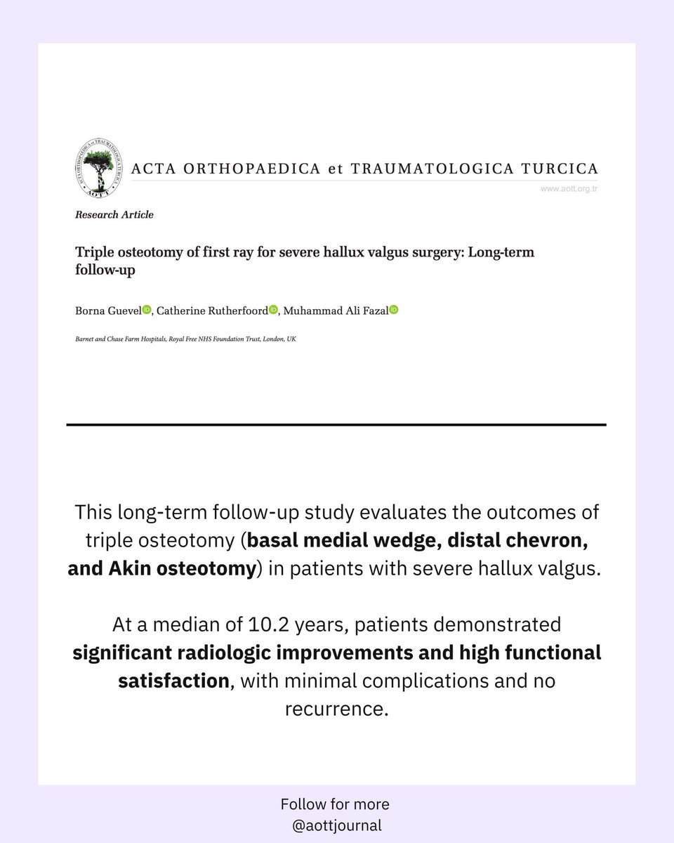 🦶 Hallux valgus deformity? Triple osteotomy shows promising long-term outcomes!
Basal medial wedge, distal chevron, and Akin osteotomy for severe hallux valgus yields lasting correction &amp; high satisfaction at 10.2 years.
📊 No recurrences, strong FAOS scores
#Orthopedics