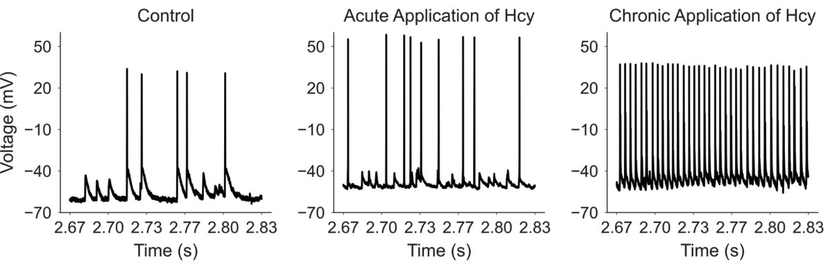New paper in collaboration with <a href="/Cbv_SAS/">Centre of Biosciences SAS</a> &amp; <a href="/CharlesUniPRG/">Charles University</a> on the effect of #homocysteine on the excitability of hippocampal neurons #ionchannels #homocysteinemia ➡️ rb.gy/etbwoj