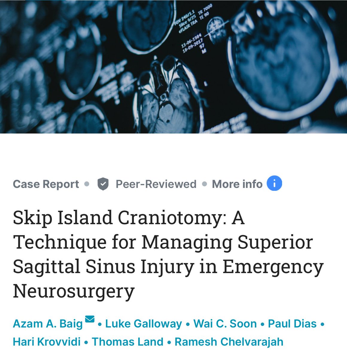 Excellent publication on a novel emergency operative neurosurgery technique to manage superior sagittal sinus injuries.

Well done team 👏

cureus.com/articles/35723…