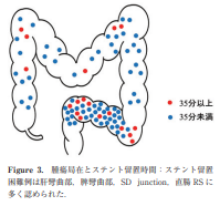 Dr_moto_clinic's tweet photo. 屈曲部（赤丸部）にステント入れる時は難渋する可能性が高いので、
●上部スコープ使ったり
●カテをswingにしたり（ENGETSUもいいかも！）
●症例によってはダブルバルーンを使ったり
すると良いという論文。勉強になりました。

日消誌 2025；122：278―287 https://t.co/whZZGsqOZj
