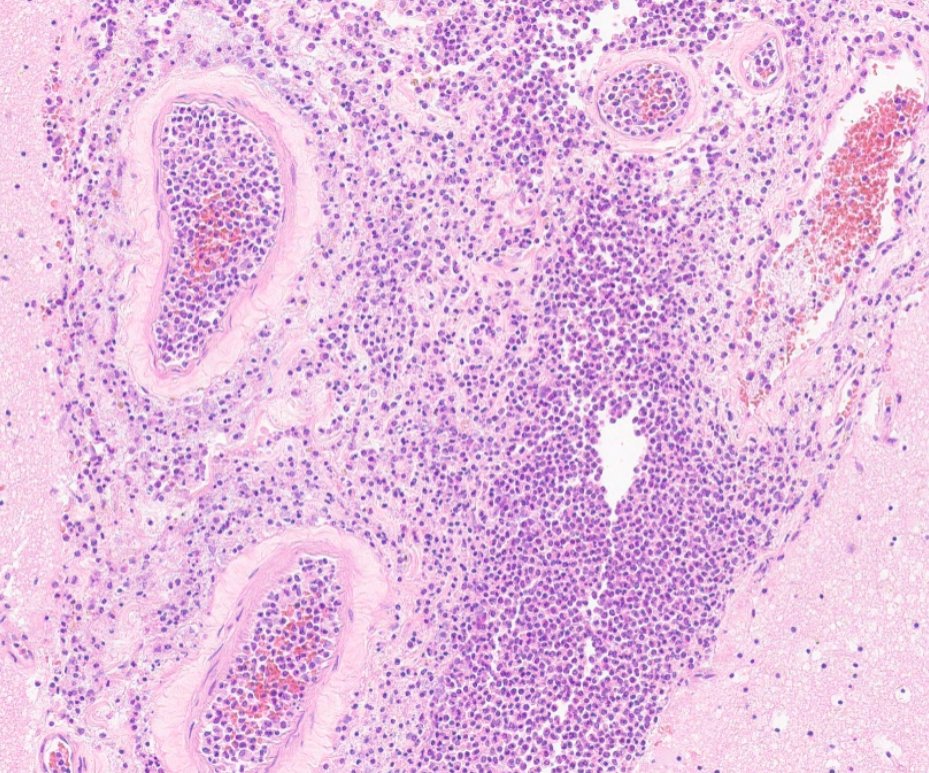 Virtual Pathology at The University of Leeds tweet media