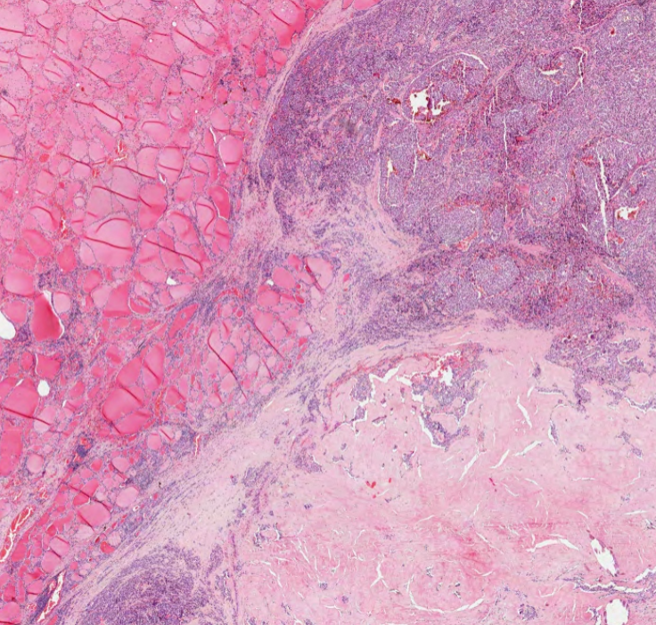 Virtual Pathology at The University of Leeds tweet media