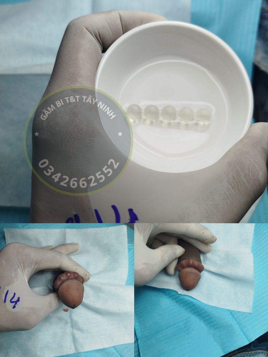 Chuỗi 5viên 8mm #gambi #catbaoquydau#vobi