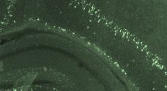 It’s #WorldParkinsonsDay.

Parkinson’s affects 10M+ people worldwide. No cure. No known cause. But there’s progress.

A new study <a href="/WeizmannScience/">Weizmann Institute</a> and Ichilov found unique breathing changes in Parkinson’s patients—offering hope for early detection. 

#Parkinsons #Neuroscience