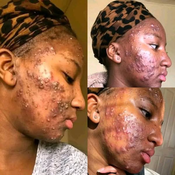 angelferxoxo's tweet photo. “Please could you assist". What is the best remedy for this condition? https://t.co/IvARTSA1Ay