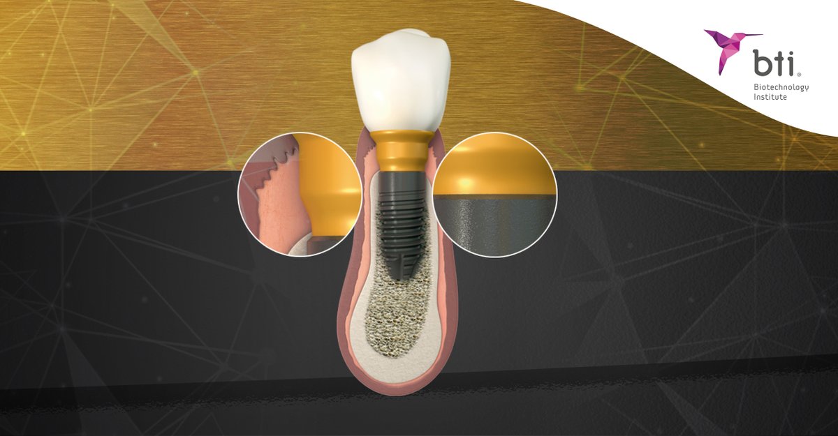 BTIBiotech's tweet photo. ¿Quieres prevenir la periimplantitis? 💡
El hermetismo en la unión implante-transepitelial-prótesis del concepto Bioblock® previene la filtración bacteriana y la periimplantitis.
Infórmate aquí 👉 https://t.co/zcEl0eJnsH
#Periimplantitis #Bioblock https://t.co/rTNOX07ZMy