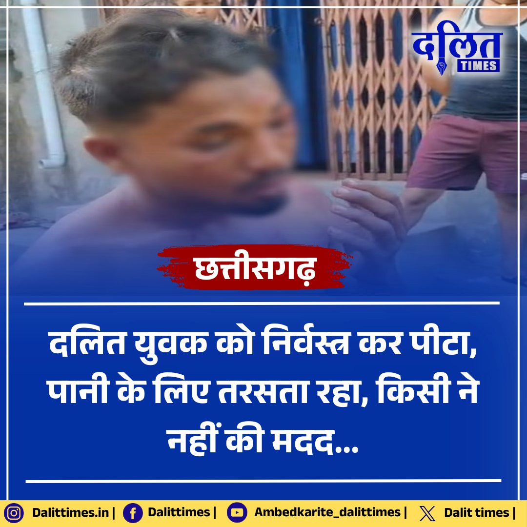 DalitTime's tweet photo. छत्तीसगढ़ : दलित युवक को निर्वस्त्र कर पीटा, पानी के लिए तरसता रहा, किसी ने नहीं की मदद...  सिर, आंख और शरीर के अन्य हिस्सों में  आई गंभीर चोटें... घटना छत्तीसगढ़ के सक्ती की है... 

@CG_Police  #dalitimes | #Dalitlivesmatter https://t.co/eHdRa5Rbqr