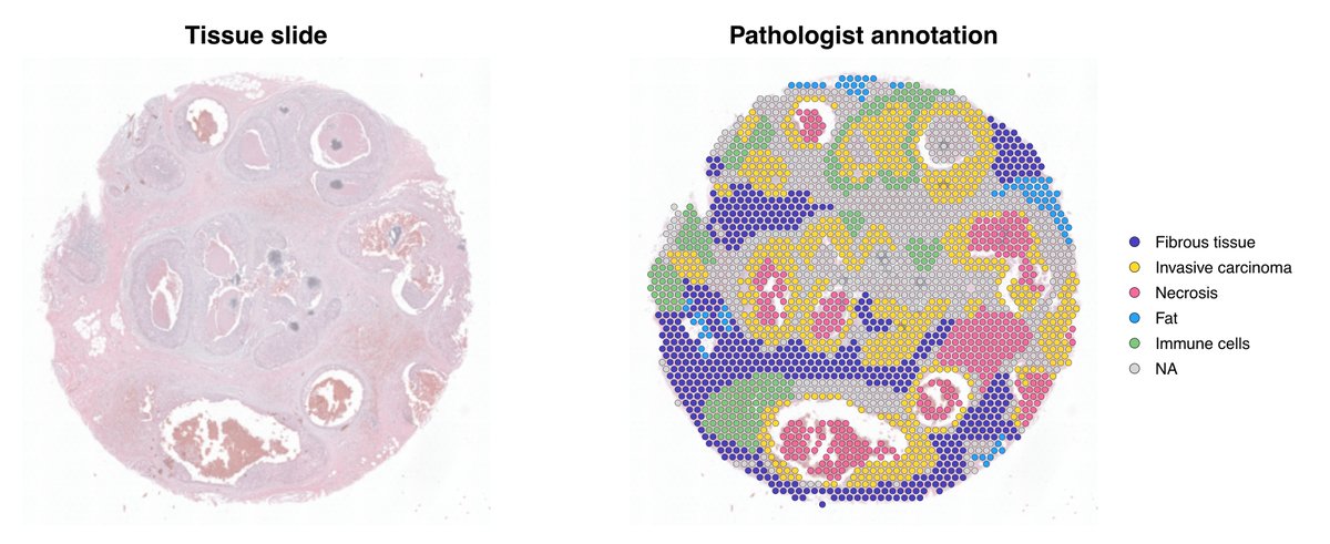 How to squeeze your spatial transcriptomics data? 🍋
Some scientists claim spatial transcriptomics (ST) will replace single-cell technologies. Others say it's just a pricier single-cell with a nice visual output. So...who's right?

A thread on #SpatialTranscriptomics ⬇️