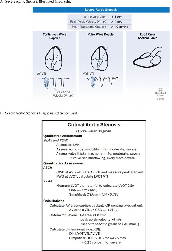 ZHeart11768530's tweet photo. 🔴Point-of-care ultrasound diagnosis of acute valvular emergencies⤵️ #2025Review 
 
🔹https://t.co/iHcpq7P1K1
#POCUS #Cardiology #FOAMed #MedEd #medstudent #paramedic #Cardiology #CardioEd #medtwitter #meded #CardioTwitter #cardiotwiteros  #MedX #cardiovascular https://t.co/FW10uLB4he