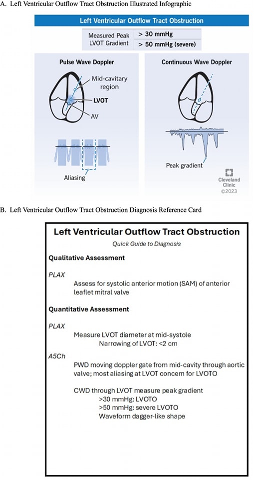 ZHeart11768530's tweet photo. 🔴Point-of-care ultrasound diagnosis of acute valvular emergencies⤵️ #2025Review 
 
🔹https://t.co/iHcpq7P1K1
#POCUS #Cardiology #FOAMed #MedEd #medstudent #paramedic #Cardiology #CardioEd #medtwitter #meded #CardioTwitter #cardiotwiteros  #MedX #cardiovascular https://t.co/FW10uLB4he