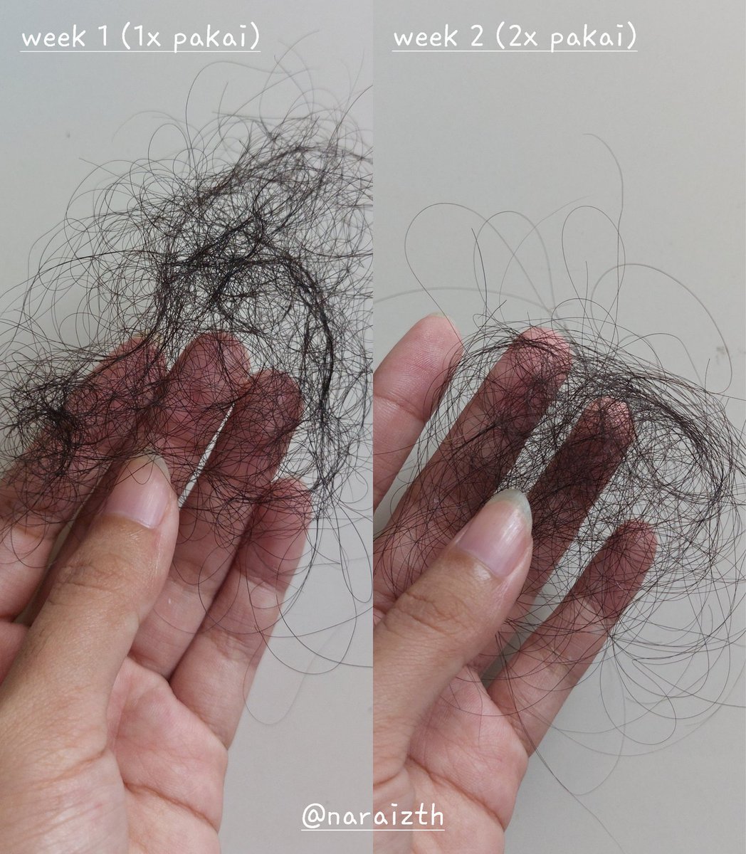 banyak bgt yg nanyain rambut aku sepanjang ini rontok ga sii?! RONTOK GUYS.. 🥲💔

TP SEKARANG UDAH JAUH BERKURANG BGTT SEJAK PAKE INII🥹🫶🏻