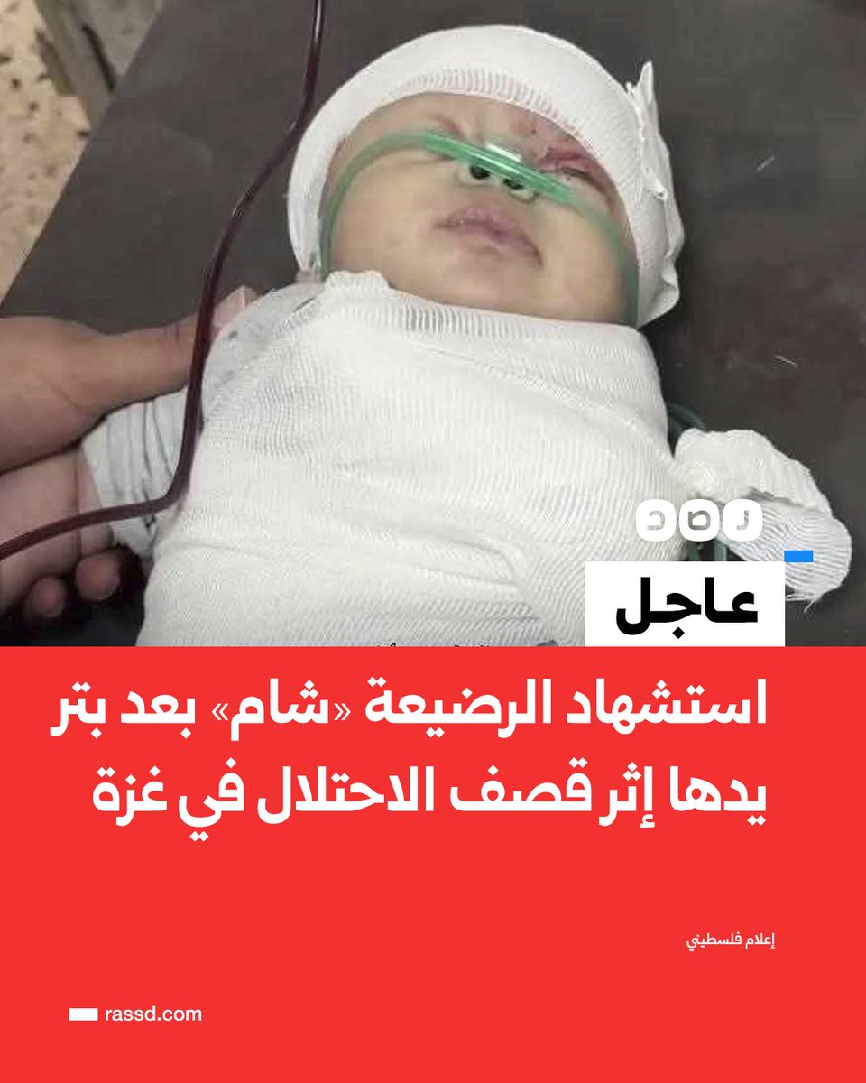 RassdNewsN's tweet photo. تغطية صحفية | استشهاد الرضيعة «شام» بعد بتر يدها إثر إصابتها في قصف الاحتلال حي الشجاعية بقطاع غزة (إعلام فلسطيني) https://t.co/ozyB2DUT21