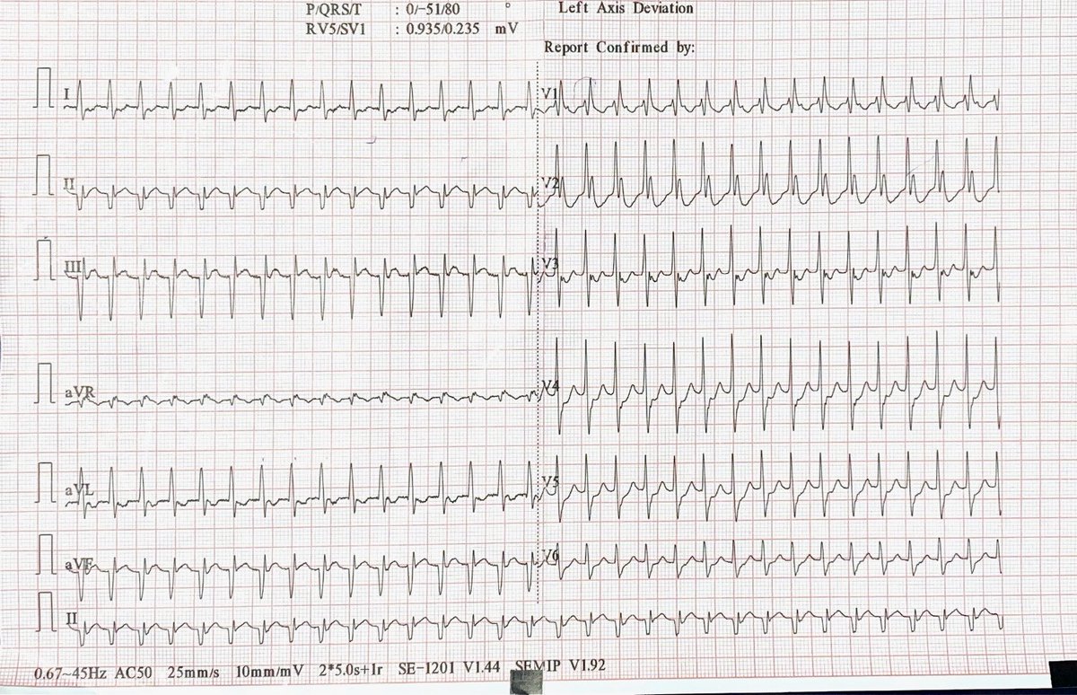 ECG for fellows