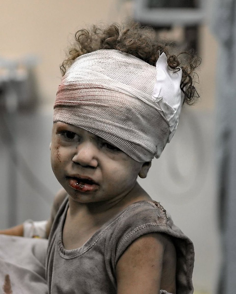 hamdaneldahdouh's tweet photo. If this were your child… would you still scroll past?

This is a wounded child in Gaza covered in ash, blood, and fear.
He was playing. Laughing. Dreaming. Until the sky fell.

He could be your son. Your little brother. Your world. https://t.co/Bc5oTHWAzk
