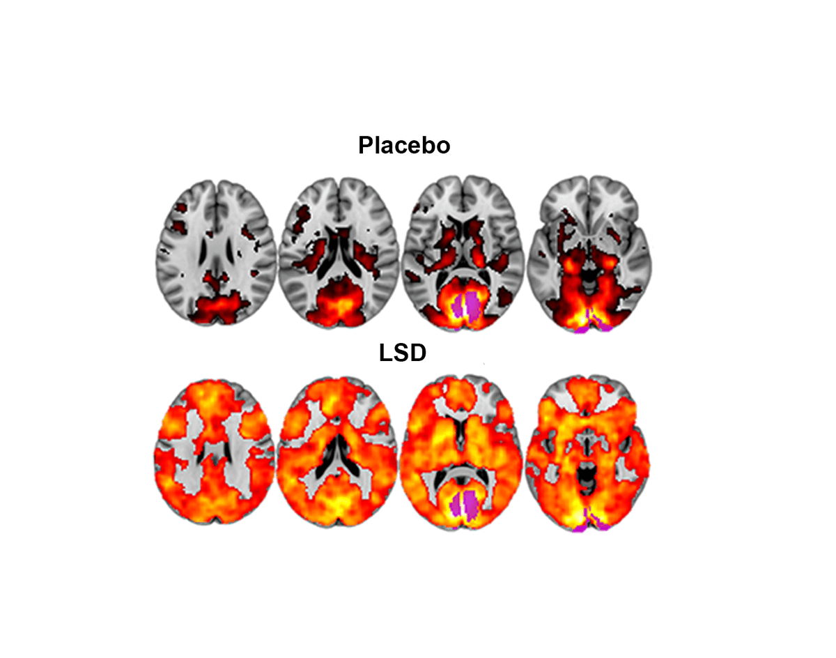NikHuno's tweet photo. The biggest secret behind Apple’s $3T empire:

LSD.

Jobs called his acid trip “one of the most important things in my life.”

How it rewired his brain—and changed Apple’s forever:🧵 https://t.co/JQxEzMNrbv