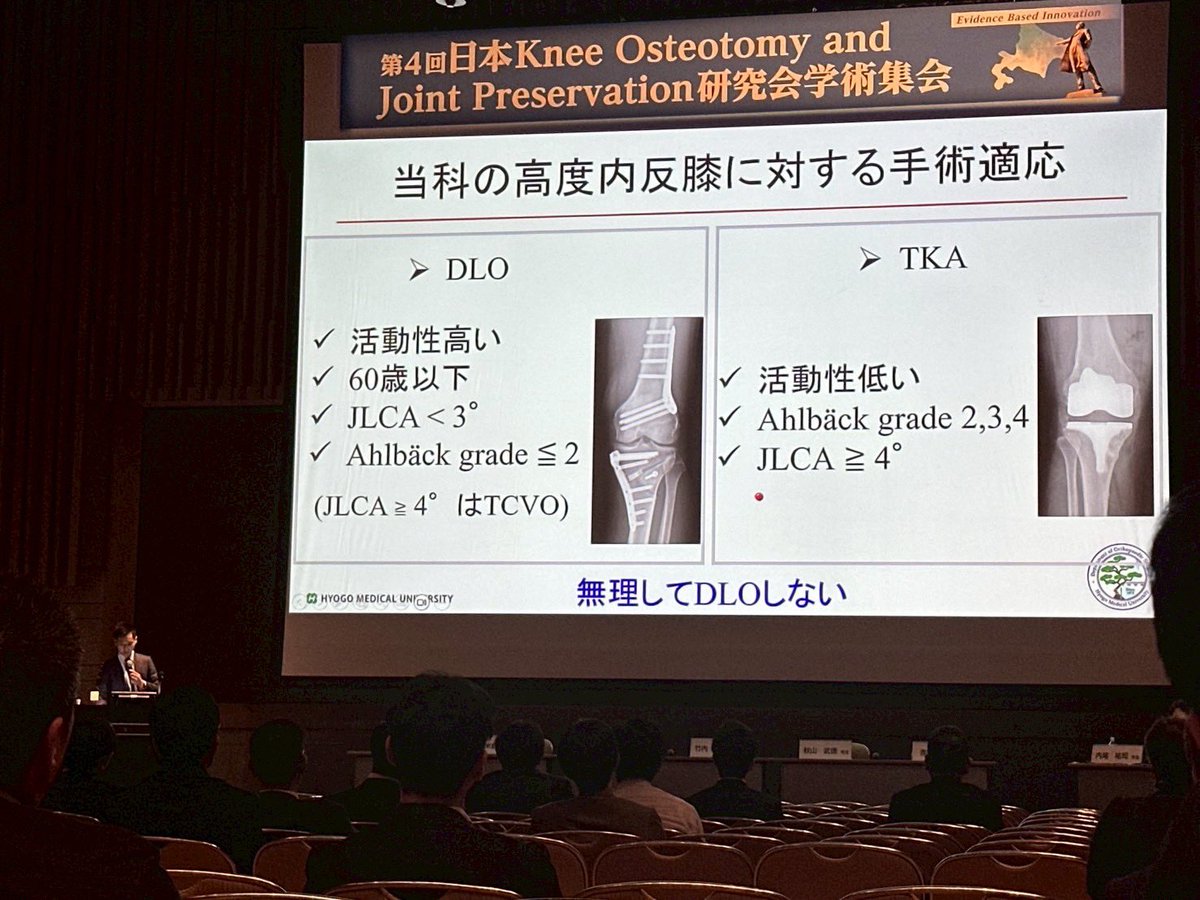 hiroshi0273's tweet photo. シンポジウム🦵

#日本kneeosteotomyandjointpreservation研究会 
#jkops 

#40センチから片足で立てる様に
#半月板切除はお控えください
#arthroscopicbeltcapsulodesis 
#meniscotibialligament 
#内側半月板逸脱 
#abc法 
#半月板制動術 
#膝矯正術
#新時代のAKO https://t.co/tPMccQCB5K