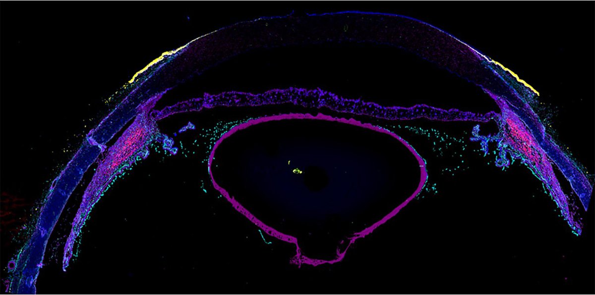 NIH_CommonFund's tweet photo. It might be too cornea to say, but Iris-k it! Take one look at this CODEX image of the anterior of a human eye from #_hubmap researchers Drs. Angela Kruse &amp; Thai Pham @spragginslab @VanderbiltU. You will see that their work is visionary, the (h)eye-est complement possible 😊 https://t.co/mAgPW4NsJR
