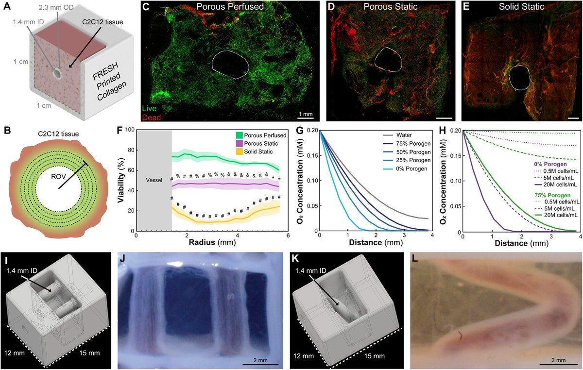 Dan Shiwarski, Ph.D. (@shiwarskilab) on Twitter photo Check out our newly published work by <a href="/Andrew_Hudson3D/">Andrew Hudson</a> and the Feinberg Lab to Enhance Viability in Static and Perfused 3D Tissue Constructs Using Sacrificial Gelatin Microparticles doi.org/10.1021/acsbio… <a href="/ACSBiomaterials/">ACS Biomat Sci & Eng</a> <a href="/PittVMI/">Vascular Medicine Institute</a> <a href="/PittBioE/">Pitt Bioengineering</a> Check out our newly published work by <a href="/Andrew_Hudson3D/">Andrew Hudson</a> and the Feinberg Lab to Enhance Viability in Static and Perfused 3D Tissue Constructs Using Sacrificial Gelatin Microparticles doi.org/10.1021/acsbio… <a href="/ACSBiomaterials/">ACS Biomat Sci & Eng</a> <a href="/PittVMI/">Vascular Medicine Institute</a> <a href="/PittBioE/">Pitt Bioengineering</a>