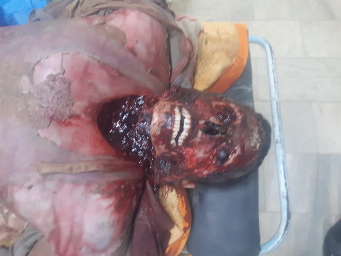 user_hafsaeng's tweet photo. #Ziad_Tariq
 a young Sunni Iraqi man from #Samarra 
was bur|ned to de|ath with #nitric acid by the #Saraya_al_Salam militia of Muqtada al-Sadr

 After #Ziad many young men were kidnapped "they belong to the same religion" https://t.co/eMMhqXGgya