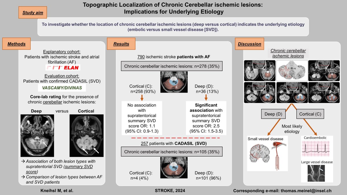 Stroke AHA/ASA (@strokeaha_asa) on Twitter photo #STROKE: The topography of cerebellar ischemic lesions may inform an understanding of their underlying etiology. <a href="/anna_kopczak/">Anna Kopczak</a> <a href="/marco_pasi85/">Marco Pasi</a> <a href="/MarcoDuering/">Marco Duering</a> <a href="/TotoMynell/">Thomas Meinel</a> <a href="/FishingNeurons/">Urs Martin Fischer</a> #AHAJournals ahajrnls.org/42CwAhU #STROKE: The topography of cerebellar ischemic lesions may inform an understanding of their underlying etiology. <a href="/anna_kopczak/">Anna Kopczak</a> <a href="/marco_pasi85/">Marco Pasi</a> <a href="/MarcoDuering/">Marco Duering</a> <a href="/TotoMynell/">Thomas Meinel</a> <a href="/FishingNeurons/">Urs Martin Fischer</a> #AHAJournals ahajrnls.org/42CwAhU