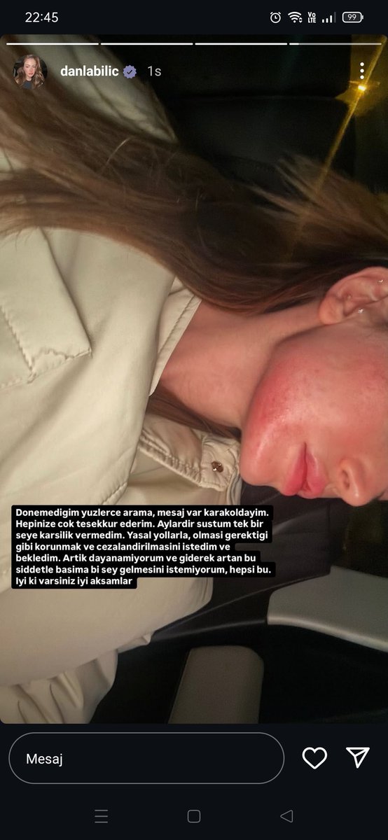 8ilayydaa's tweet photo. Danla'nın ünlü olması hiçbir şeyi değiştirmez, "çok takipçisi var onlar destek olur" diyip geçmek duyarsızlıktır. Bir kadının daha hayatı cehenneme dönmeden acil müdahale yapılması gerekiyor. Umarız bu sefer adalet gecikmeden yerini bulur. #danlabilic #DanlaBilicinYanındayız https://t.co/EmcW6JV3Xk