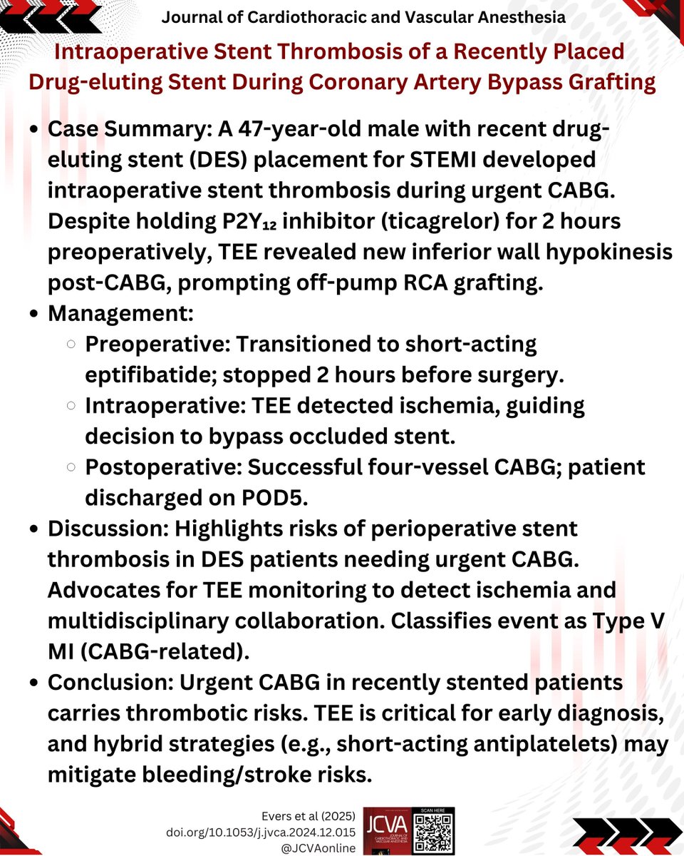 JCVAonline's tweet image. Stent Clot During Heart Surgery: A Close Call​​ ❗🩺

47yo man with heart attack got stent → needed urgent bypass 9 days later.
Stopped blood thinner 2h before surgery → ​​clot formed in stent​​ during operation.

#HeartSurgery #ClotRisk #QuickThinking 
jcvaonline.com/article/S1053-…