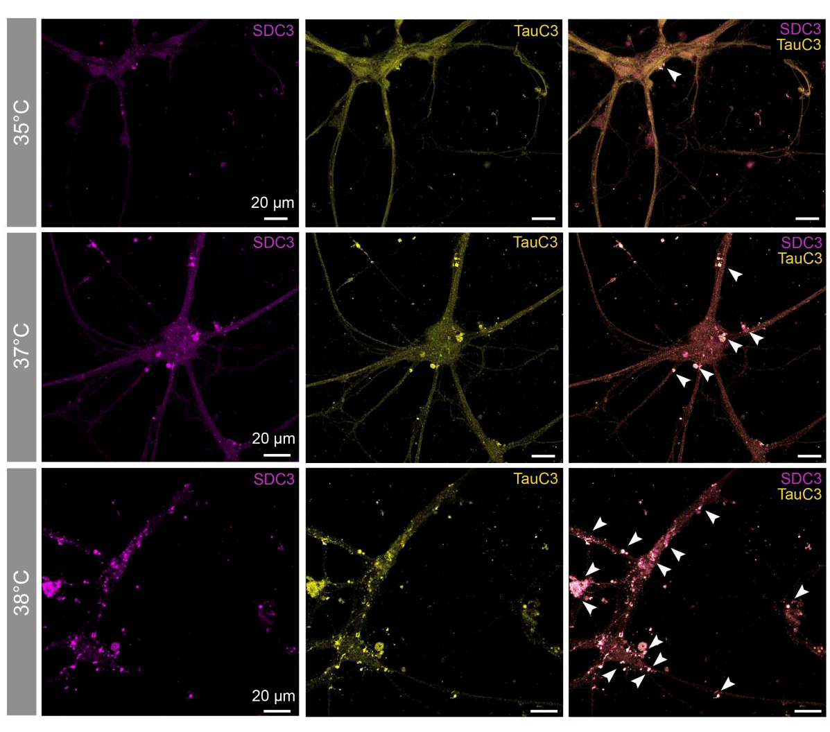 Journal of Clinical Investigation (@jclinicalinvest) on Twitter photo Another reason to sleep!
Geoffrey Canet et al. <a href="/universitelaval/">Université Laval</a> show wakefulness body temperature upregulates neuronal tau secretion and correlates with tau levels, highlighting the importance of sleep and thermoregulation in Alzheimer’s disease.
jci.org/articles/view/… Another reason to sleep!
Geoffrey Canet et al. <a href="/universitelaval/">Université Laval</a> show wakefulness body temperature upregulates neuronal tau secretion and correlates with tau levels, highlighting the importance of sleep and thermoregulation in Alzheimer’s disease.
jci.org/articles/view/…