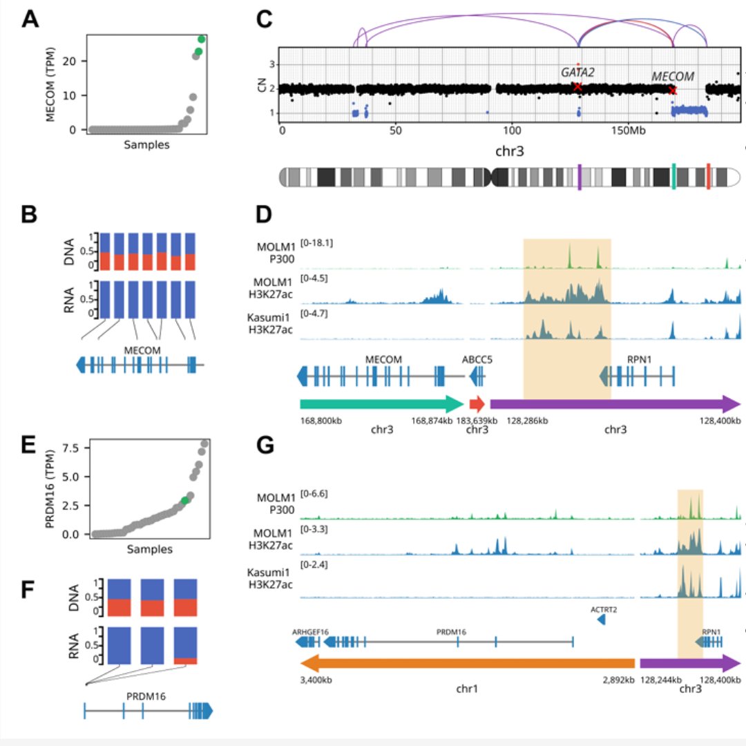 Enhancer hijacking discovery in acute myeloid leukemia by pyjacker identifies MNX1 activation via deletion 7q: brnw.ch/21wRWqT